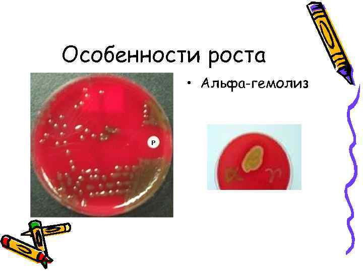 Особенности роста • Альфа-гемолиз 