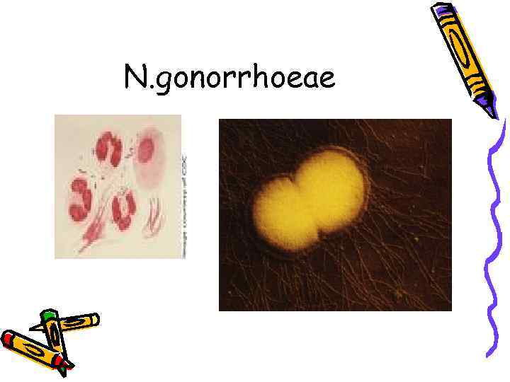 N. gonorrhoeae 