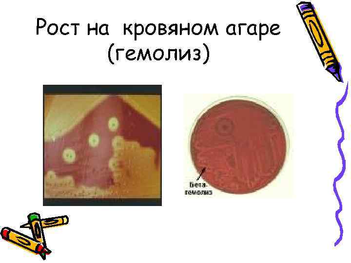 Рост на кровяном агаре (гемолиз) 