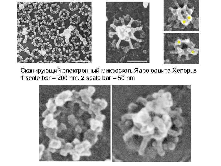 Сканирующий электронный микроскоп. Ядро ооцита Xenopus 1 scale bar – 200 nm. 2 scale