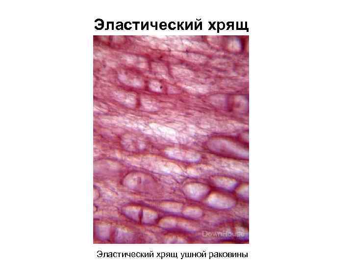 Эластический хрящ ушной раковины 