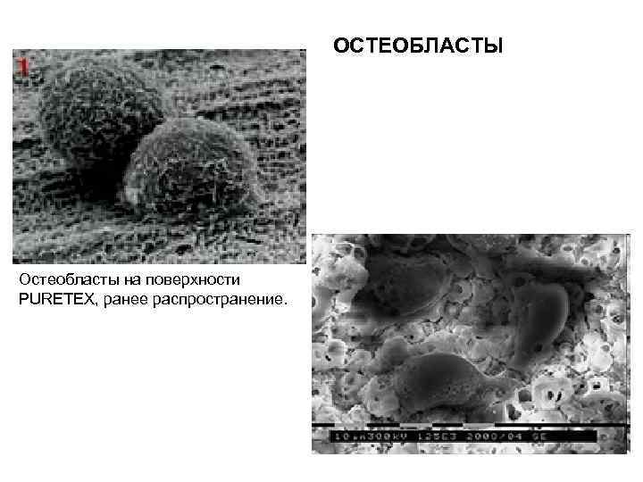 ОСТЕОБЛАСТЫ Остеобласты на поверхности PURETEX, ранее распространение. 