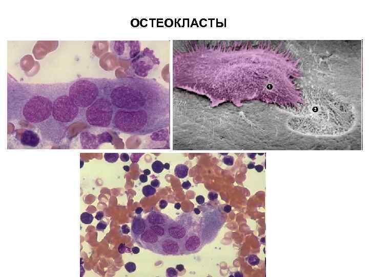 Остеокласты и остеобласты картинки