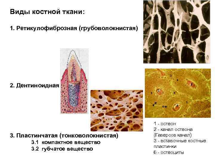 Виды костной ткани: 1. Ретикулофиброзная (грубоволокнистая) 2. Дентиноидная 3. Пластинчатая (тонковолокнистая) 3. 1 компактное