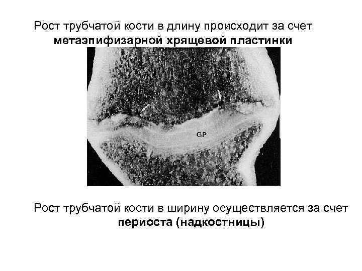 Рост трубчатой кости в длину происходит за счет метаэпифизарной хрящевой пластинки Рост трубчатой кости
