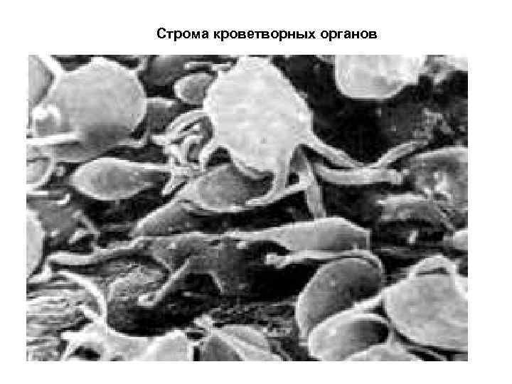 Строма кроветворных органов 