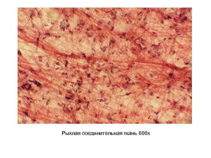 Соединенная ткань. Рыхлая соединительная ткань микропрепарат. Рыхлая соединительная ткань человека микропрепарат. Соединительная ткань мышечная ткань микропрепарат. Микропрепарат соединительной ткани.