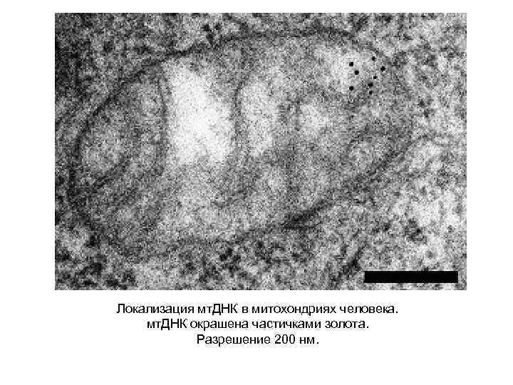 Локализация мт. ДНК в митохондриях человека. мт. ДНК окрашена частичками золота. Разрешение 200 нм.
