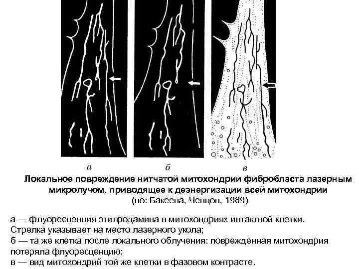 Локальное повреждение нитчатой митохондрии фибробласта лазерным микролучом, приводящее к деэнергизации всей митохондрии (по: Бакеева,
