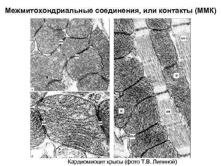Межмитохондриальные соединения, или контакты (ММК) Кардиомиоцит крысы (фото Т. В. Липиной) 