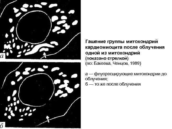 Гашение группы митохондрий кардиомиоцита после облучения одной из митохондрий (показано стрелкой) (по: Бакеева, Ченцов,