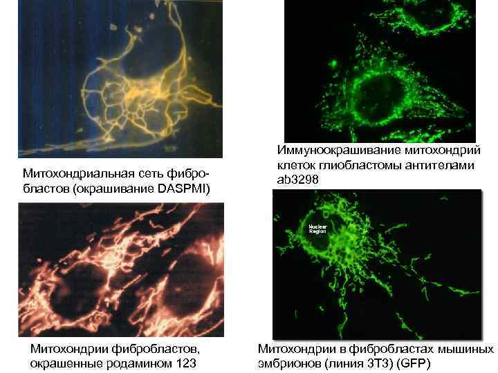 Митохондриальная сеть фибробластов (окрашивание DASPMI) Митохондрии фибробластов, окрашенные родамином 123 Иммуноокрашивание митохондрий клеток глиобластомы