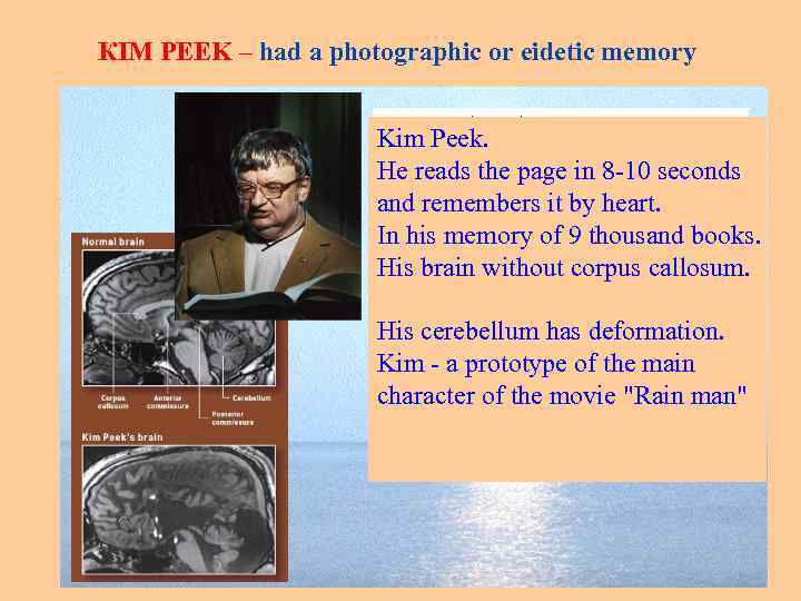 КIM PEEK – had a photographic or eidetic memory Kim Peek. He reads the