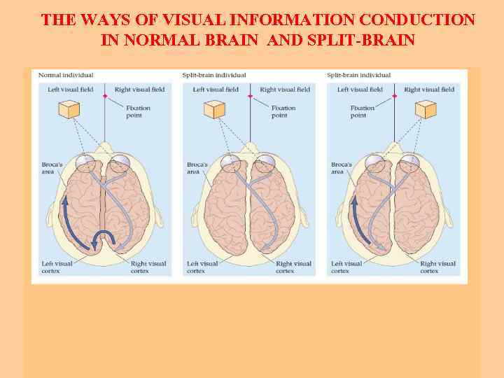 THE WAYS OF VISUAL INFORMATION CONDUCTION IN NORMAL BRAIN AND SPLIT-BRAIN 