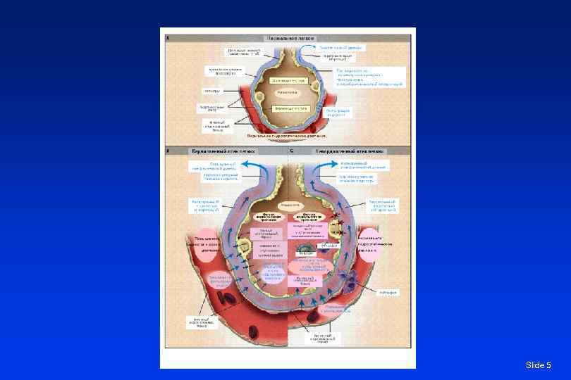 Slide 5 