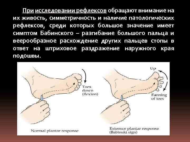 При исследовании рефлексов обращают внимание на их живость, симметричность и наличие патологических рефлексов, среди