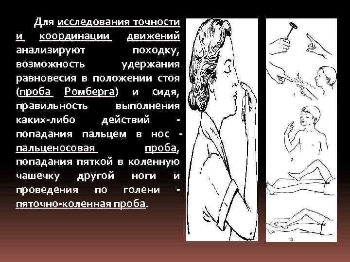 Для исследования точности и координации движений анализируют походку, возможность удержания равновесия в положении стоя