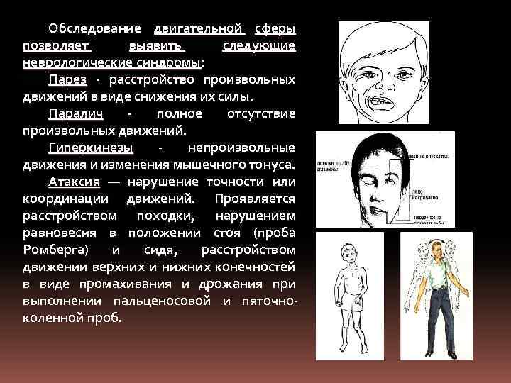 Обследование двигательной сферы позволяет выявить следующие неврологические синдромы: Парез - расстройство произвольных движений в