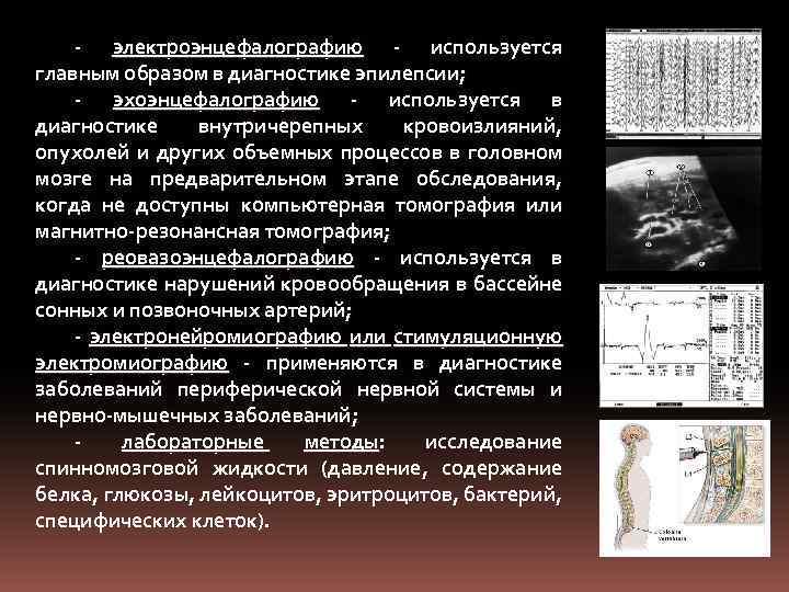 - электроэнцефалографию - используется главным образом в диагностике эпилепсии; - эхоэнцефалографию - используется в