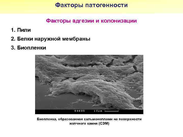 Факторы патогенности Факторы адгезии и колонизации 1. Пили 2. Белки наружной мембраны 3. Биопленки