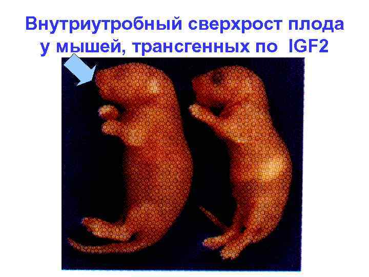 Внутриутробный сверхрост плода у мышей, трансгенных по IGF 2 