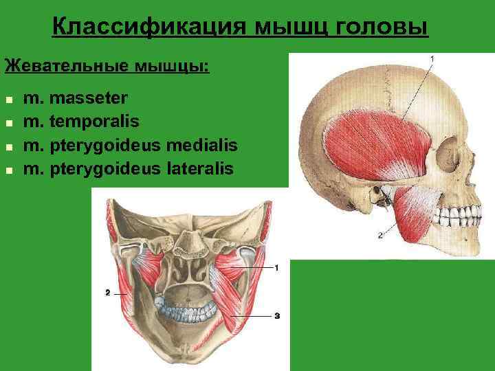 Ботокс в жевательные мышцы схема