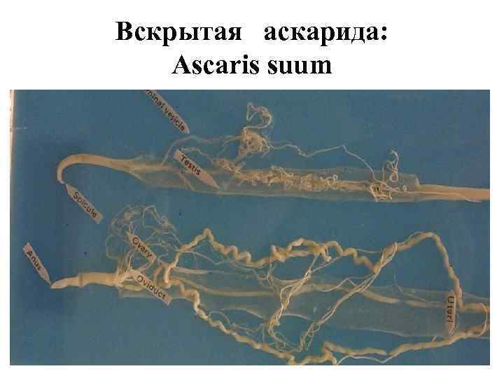 Вскрытая аскарида: Ascaris suum 