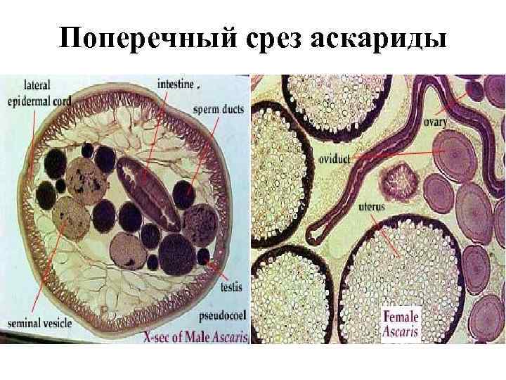 Поперечный срез аскариды рисунок