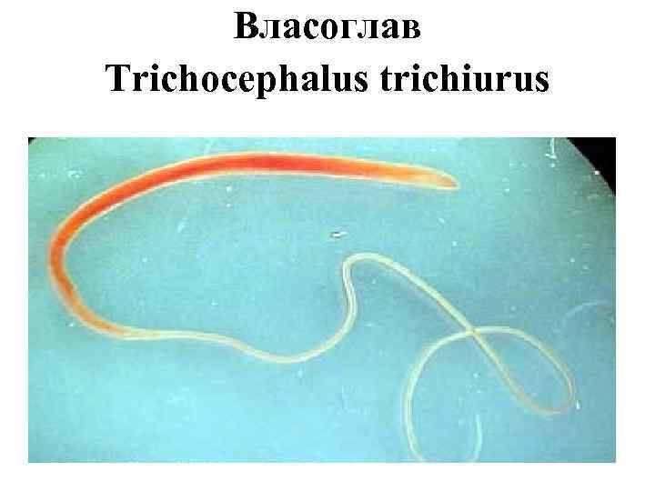 Власоглав симптомы. Власоглав человеческий (Trichocephalus Trichiurus). Власоглав препарат под микроскопом.