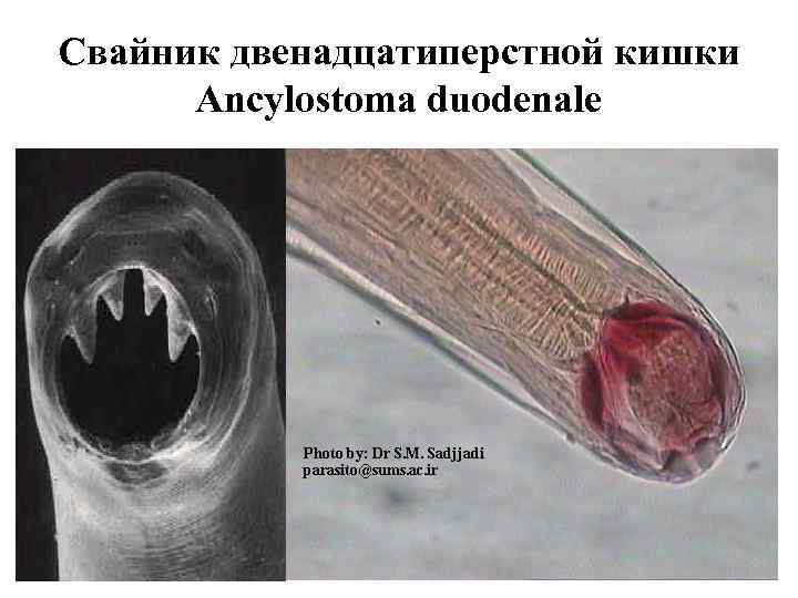 Свайник двенадцатиперстной кишки Ancylostoma duodenale 