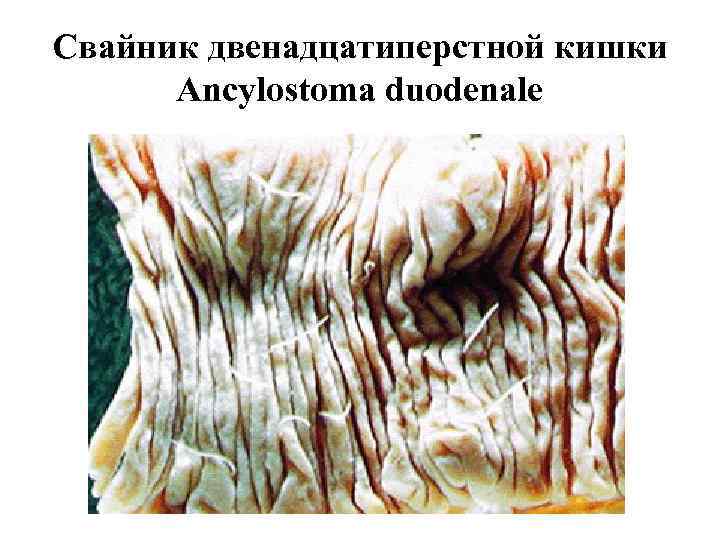 Свайник двенадцатиперстной кишки Ancylostoma duodenale 