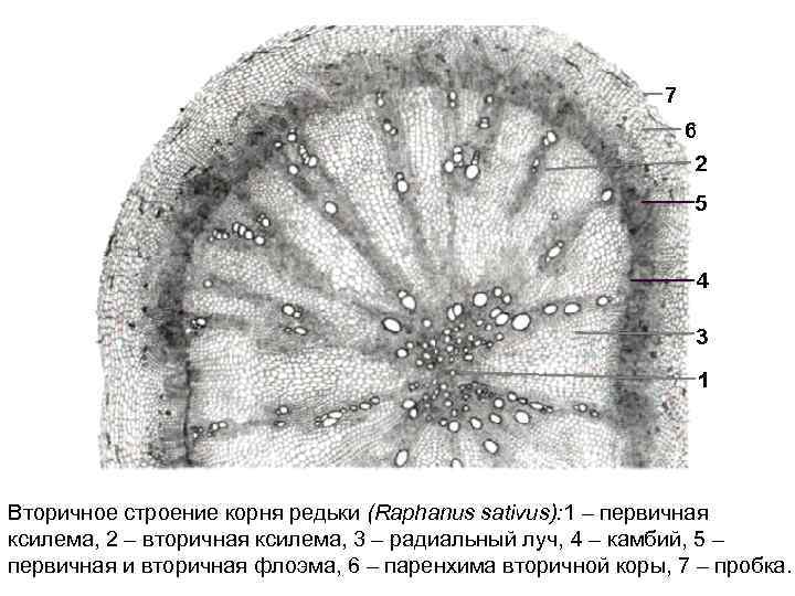 Вторичное строение. Корень редьки строение. Строение корнеплода редьки. Вторичное строение корнеплода редьки. Анатомическое строение корнеплода редьки.