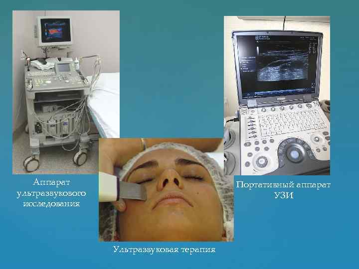 Аппарат ультразвукового исследования Портативный аппарат УЗИ Ультразвуковая терапия 
