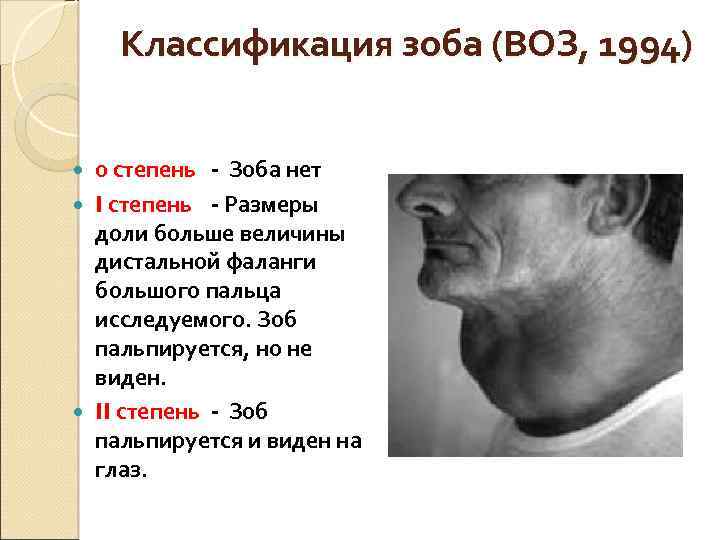 Классификация зоба (ВОЗ, 1994) 0 степень - Зоба нет I степень - Размеры доли