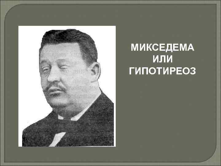 МИКСЕДЕМА ИЛИ ГИПОТИРЕОЗ 