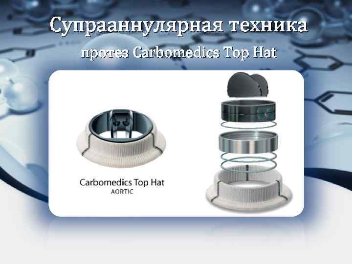 Супрааннулярная техника протез Carbomedics Top Hat 