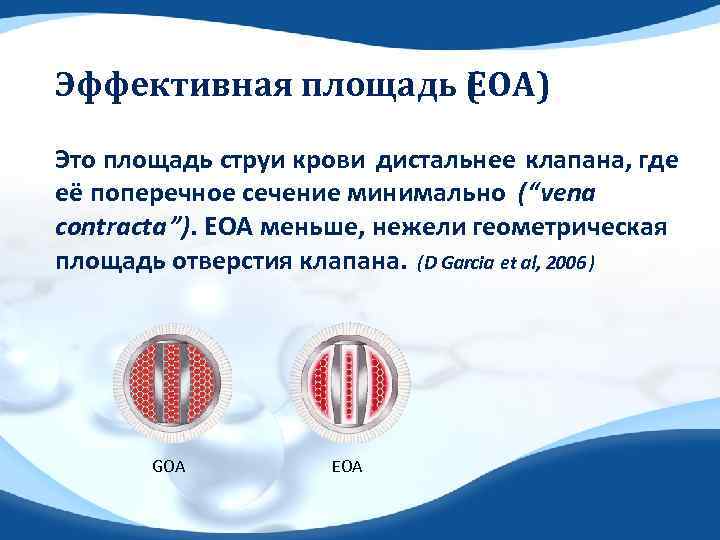Эффективная площадь ( OA) E Это площадь струи крови дистальнее клапана, где её поперечное