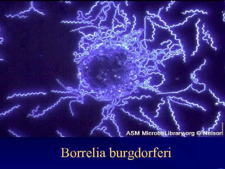 Borrelia burgdorferi 