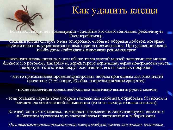 Как удалить клеща Если поблизости нет травмпункта - сделайте это самостоятельно, рекомендует Роспотребнадзор. Снимать