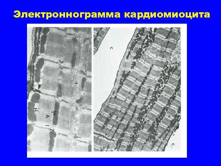 Электроннограмма кардиомиоцита 