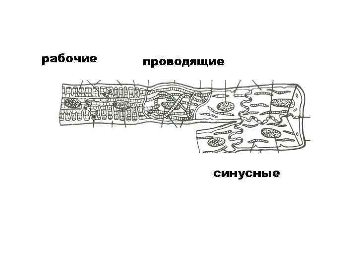рабочие проводящие синусные 