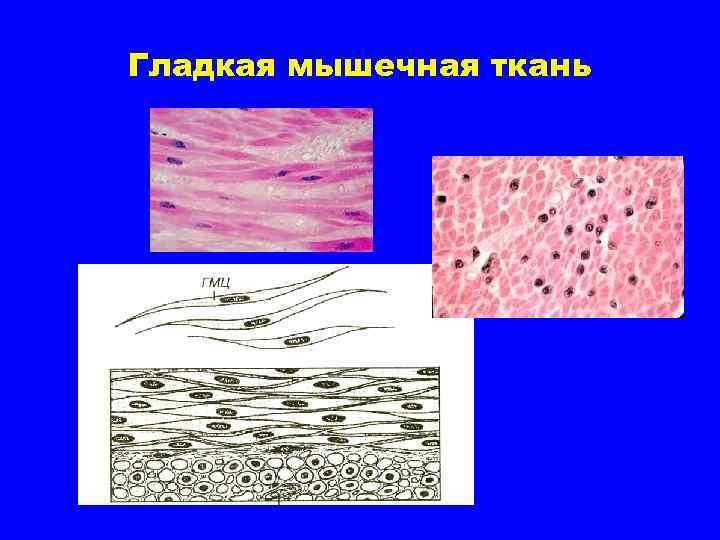 Работа гладких мышц. Мышечная ткань гистология. Гладкая мышечная ткань гистология. Гладкая мышечная ткань микрофотография. Клетки гладкой мышечной ткани под микроскопом.