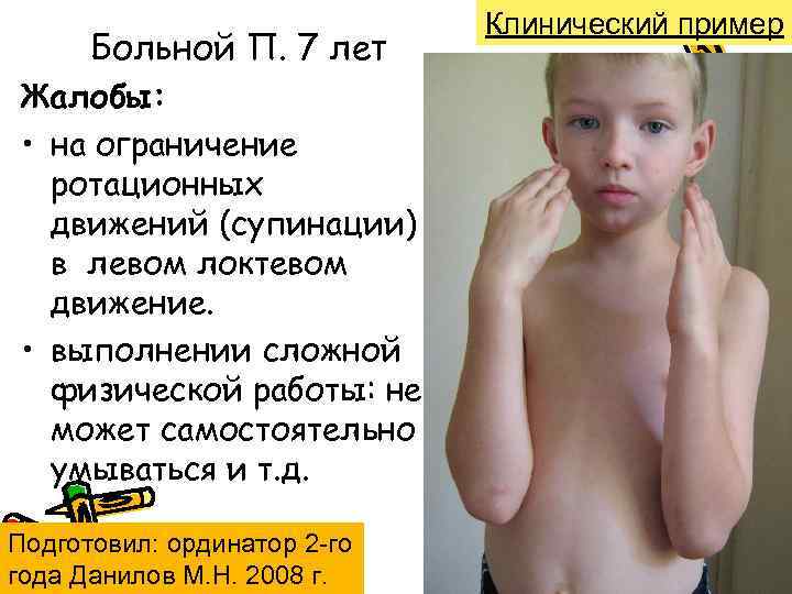 Больной П. 7 лет Жалобы: • на ограничение ротационных движений (супинации) в левом локтевом