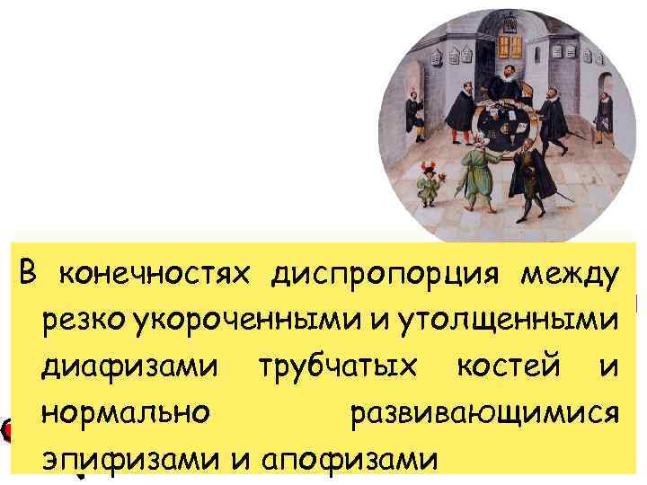 В конечностях диспропорция между резко укороченными и утолщенными диафизами трубчатых костей и нормально развивающимися