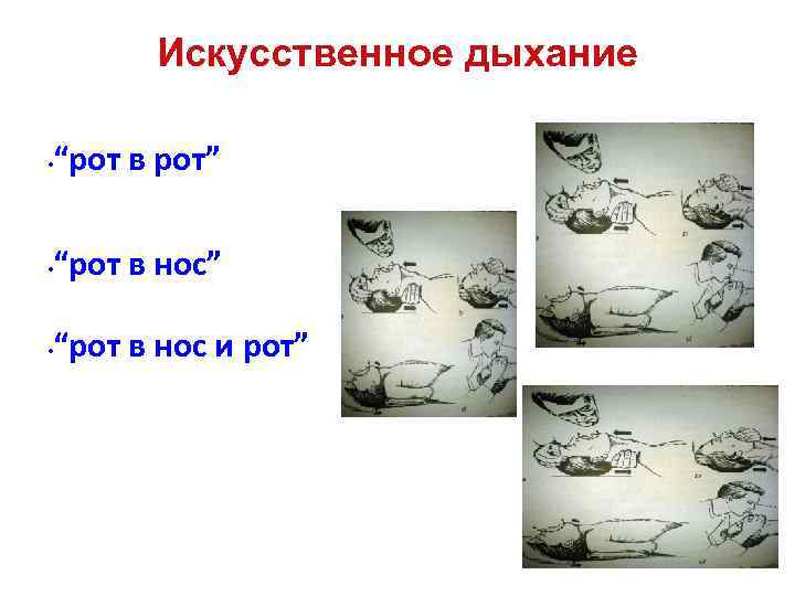 Искусственное дыхание • “рот в рот” • “рот в нос и рот” 
