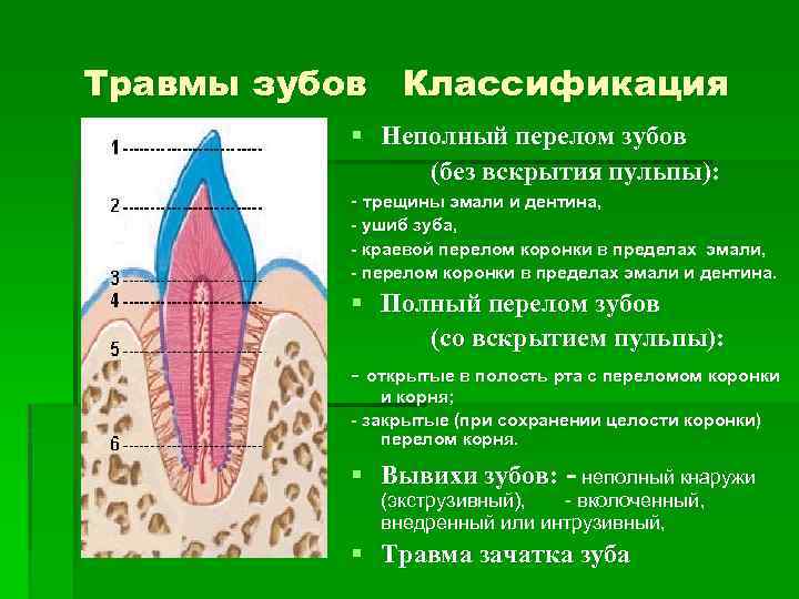 Травмы зубов у детей презентация