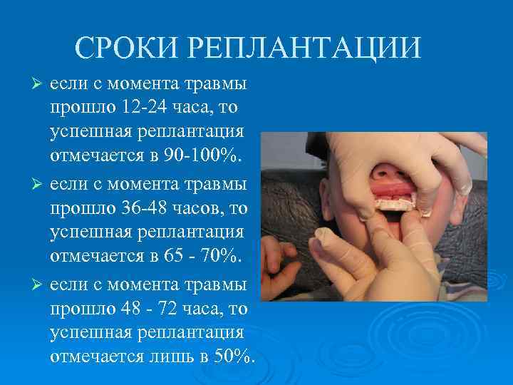 СРОКИ РЕПЛАНТАЦИИ если с момента травмы прошло 12 -24 часа, то успешная реплантация отмечается