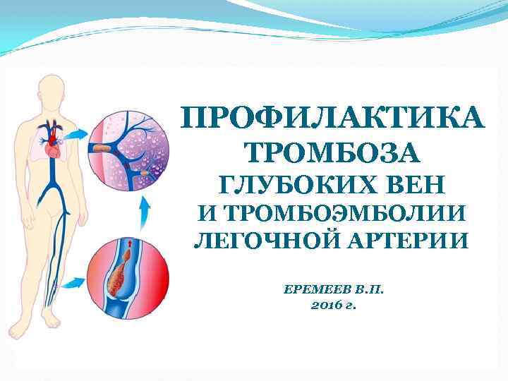 ПРОФИЛАКТИКА ТРОМБОЗА ГЛУБОКИХ ВЕН И ТРОМБОЭМБОЛИИ ЛЕГОЧНОЙ АРТЕРИИ ЕРЕМЕЕВ В. П. 2016 г. 