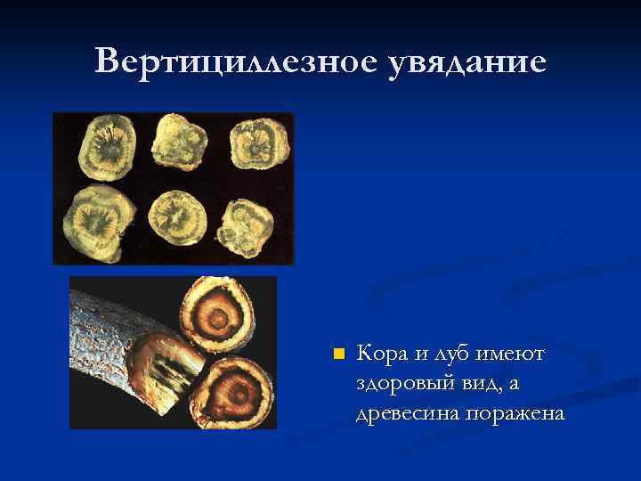 Вертициллезное увядание n Кора и луб имеют здоровый вид, а древесина поражена 