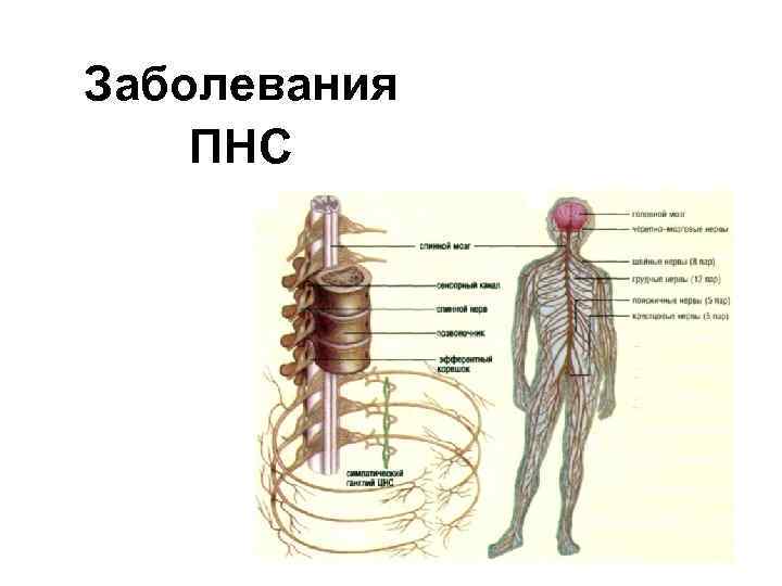 Заболевания ПНС 1 